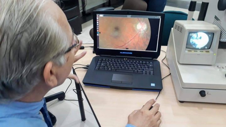 Equipos para la detención de Retinopatía Diabética, listos para servir a la comunidad.